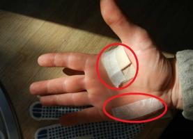 Hvordan man kan forbedre handskerne at give afkald på hård hud?